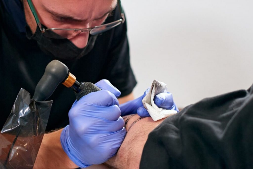 Why Consider Tattoo Removal